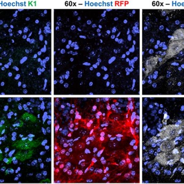 TDP-43 KD leads to increased dsRNA in motor neurons of the lumbar spinal cord compared with WT controls