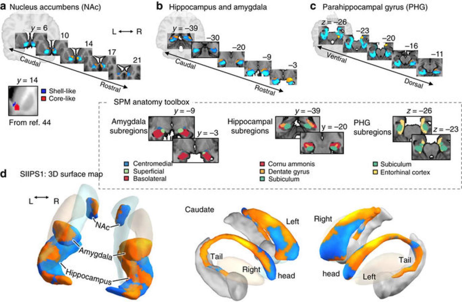 Figure from paper "Quantifying cerebral contributions to pain beyond nociception"