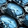 AI CPR Brain Scan Image
