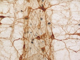 Microscopic image of neurons