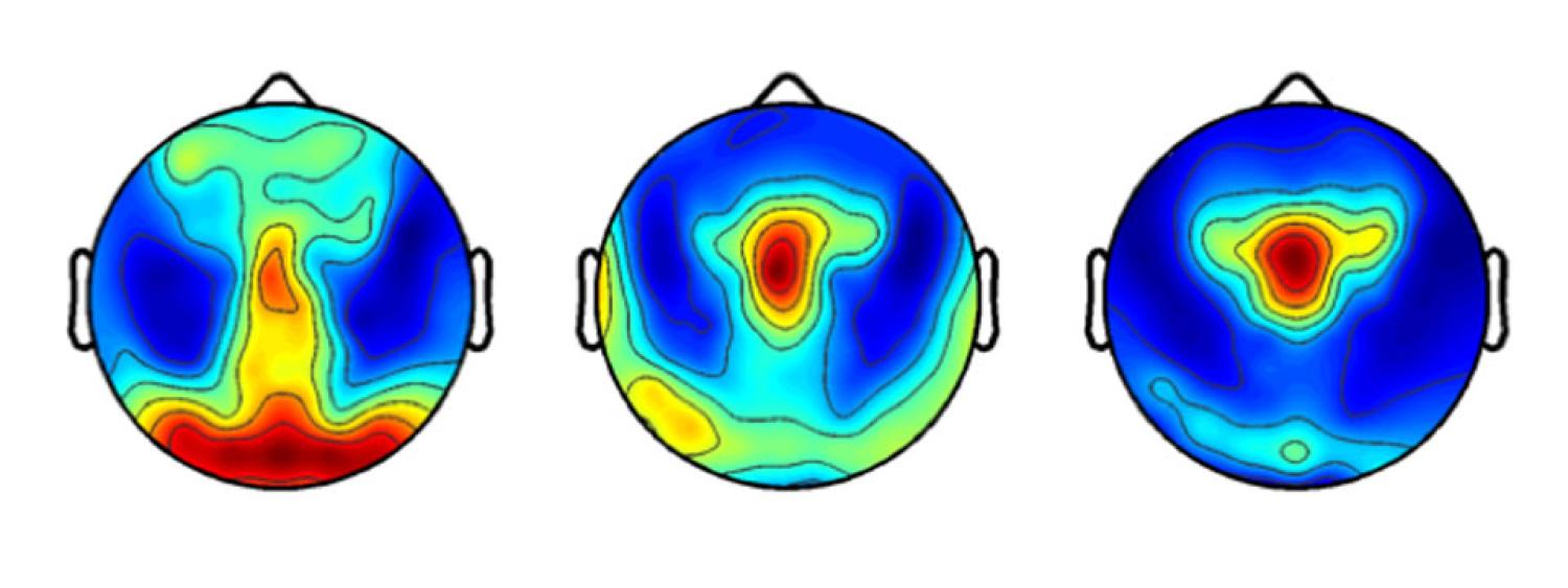 Topographical maps of sleep electroencephalography power distribution in  preschool children (red = maxima, blue = minima)
