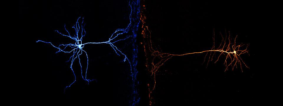 Biocytin filled neurons recorded from ipsilateral and contralateral in vitro infralimbic prefrontal cortical slices