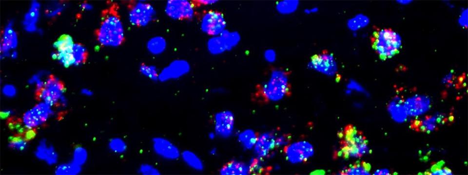 Detection of 5ht1a (red) and cFOS (yellow) mRNA in the dorsal raphe nucleus by double-labeled fluorescent in situ hybridization