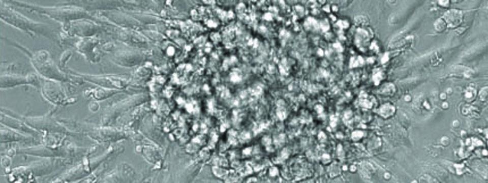 Endothelial progenitor cells in culture
