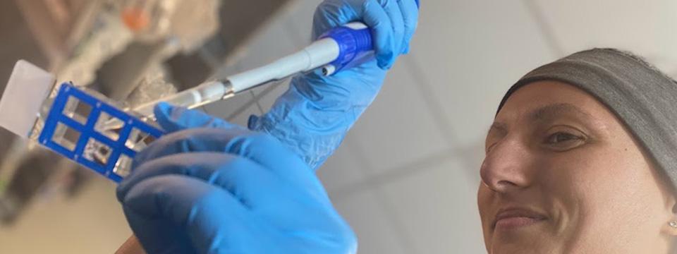 Fixing human endothelial cells on plates for future analysis