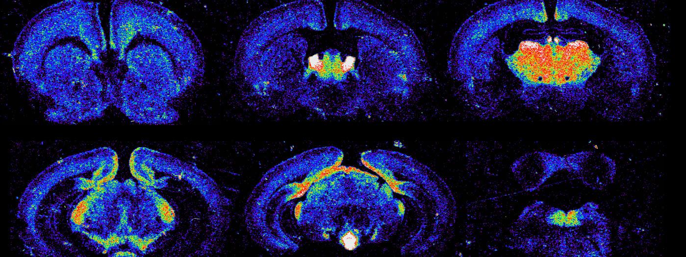 Nicotine binding throughout the brain
