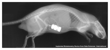 Biotelemetry