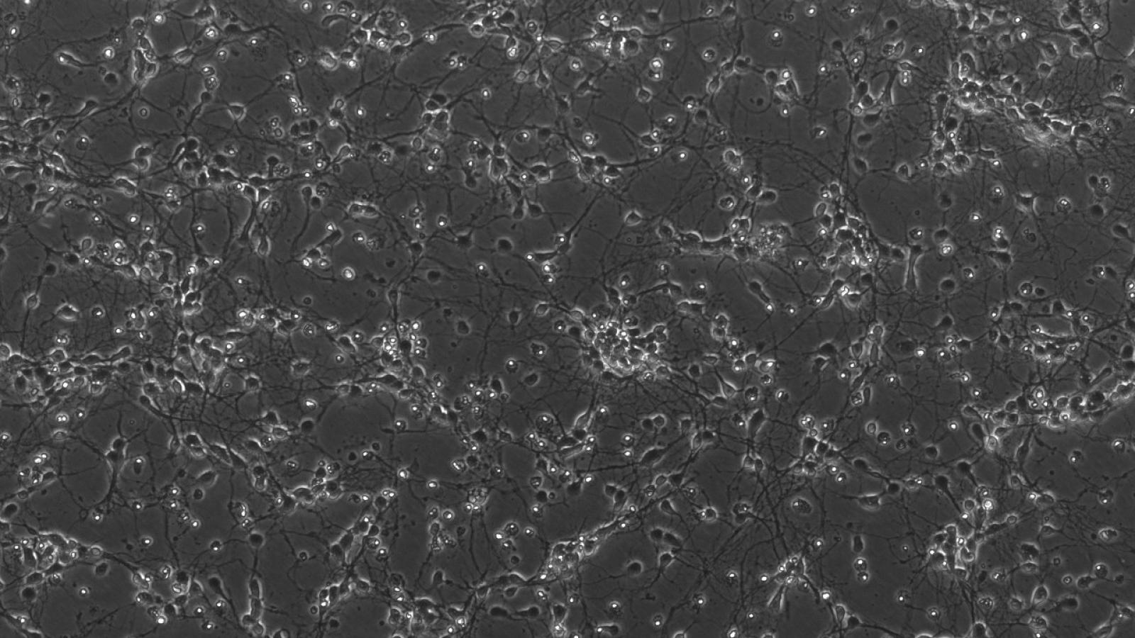 Cortical neurons