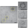 close-up electron microscopy of VLPs