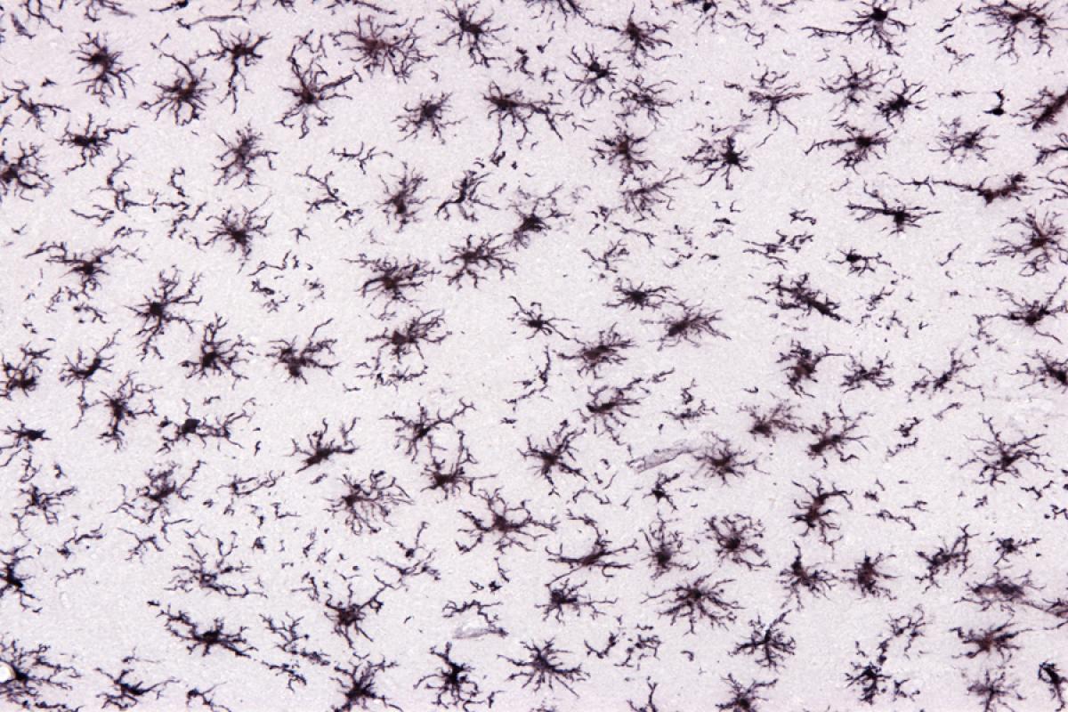 Microglia Expression