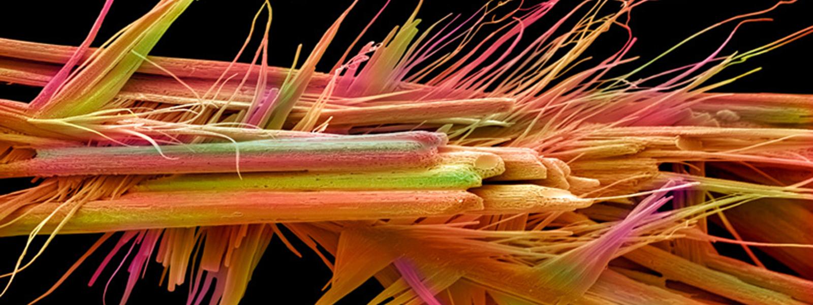 Electron micrograph of caffeine crystals. Caffeine is a bitter, crystalline xanthine alkaloid that acts as a stimulant drug. We study the effects of caffeine on the nervous system. Photo courtesy of Annie Cavanagh and David McCarthy