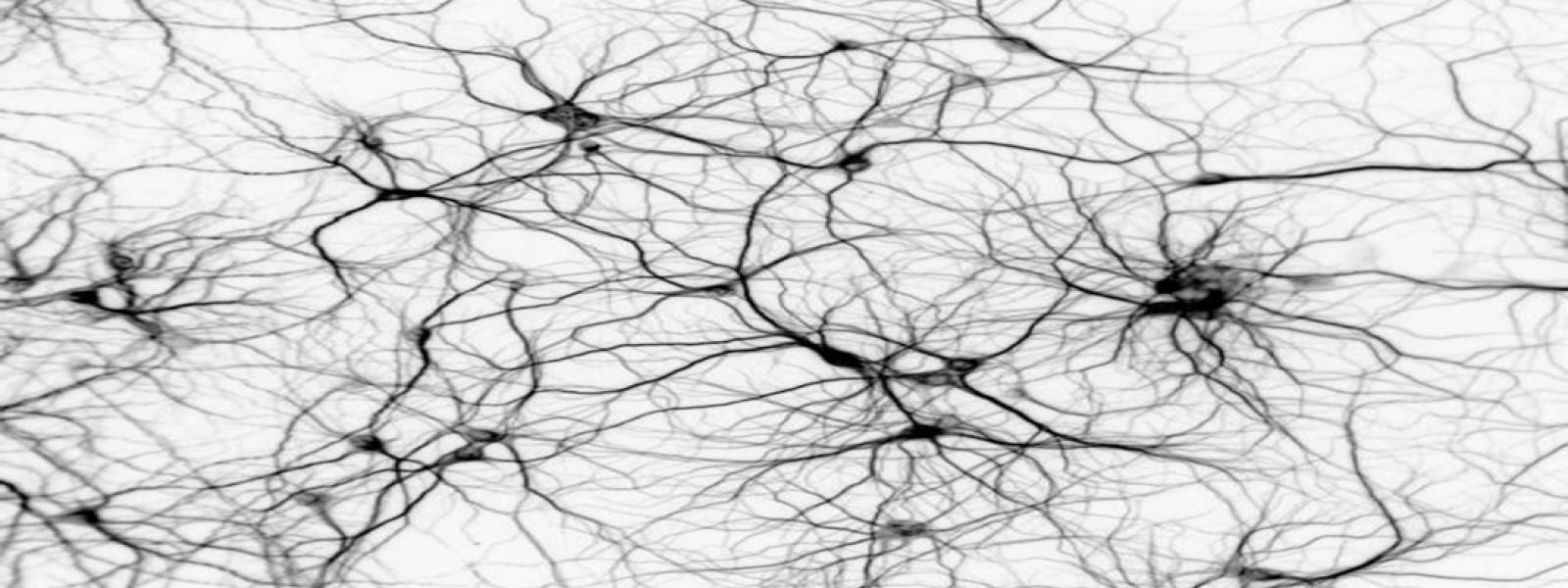 Artistic rendering of neurons