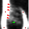 Kymograph of spindle