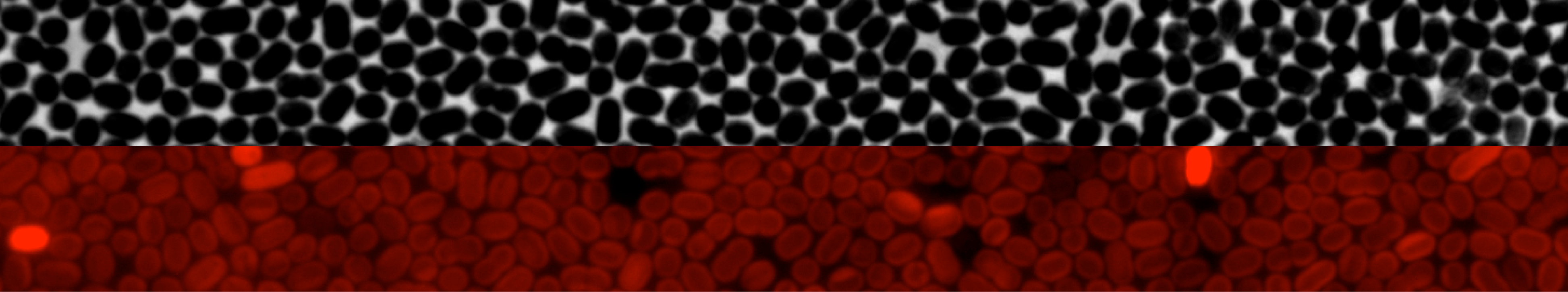 Phase contrast and chlorophyll fluorescence image of Synechococcus PCC 7002 (Photo credit: Jeffrey Cameron)