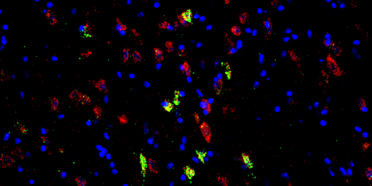 FISH neuronal image