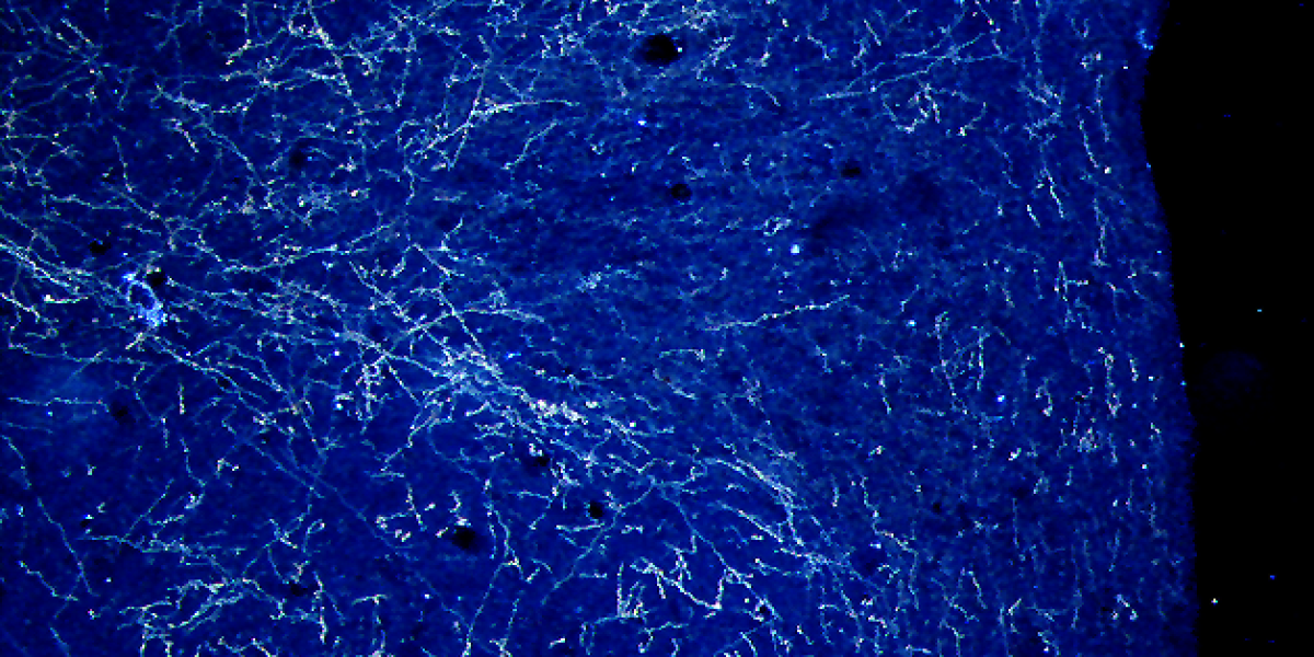 darkfield neuronal image