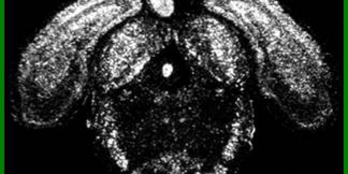 brain image section