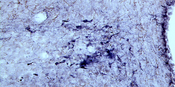 double-stained immunohistochemical image