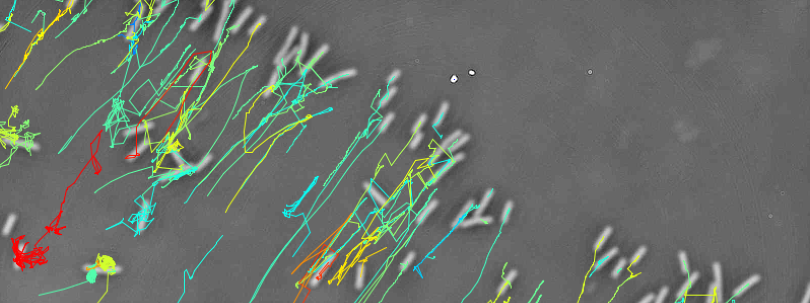 Bacteria swimming in cervical mucus