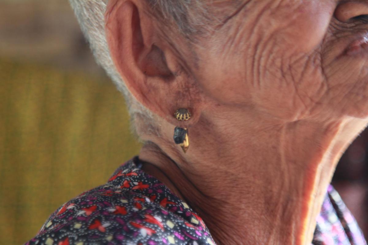 Older adult ear