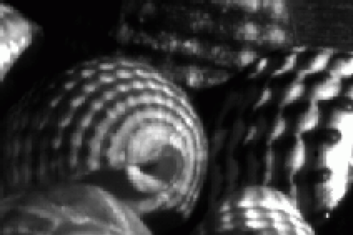 depth of field/focus image