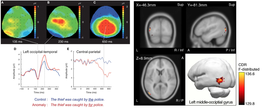 EEG Results