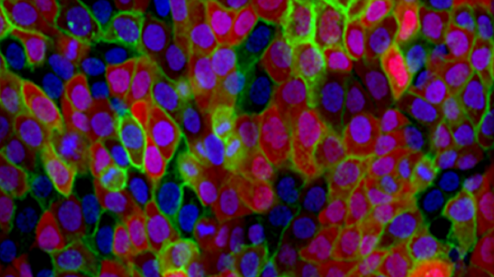 Tightly-packed cells with three fluorescent markers