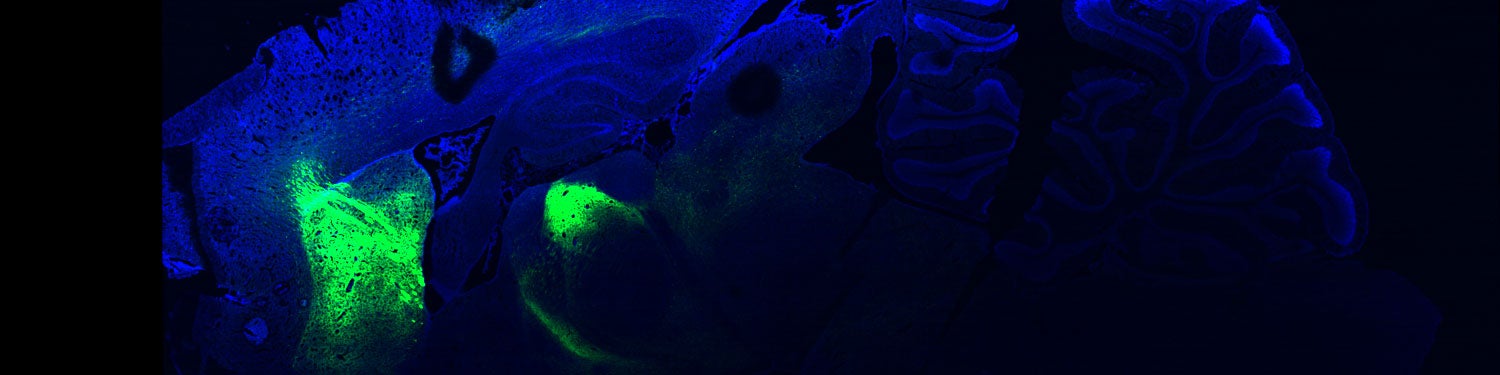 Brain cell stain image