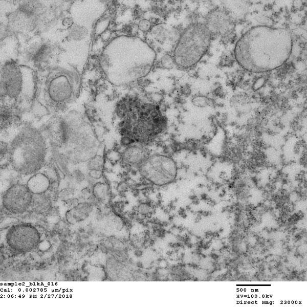 electron microscopy image
