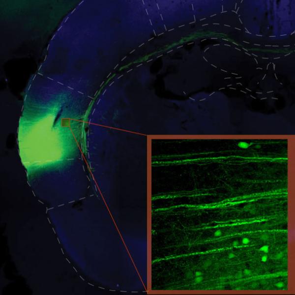 insular cortex image