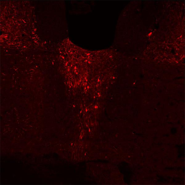 brain tissue stain