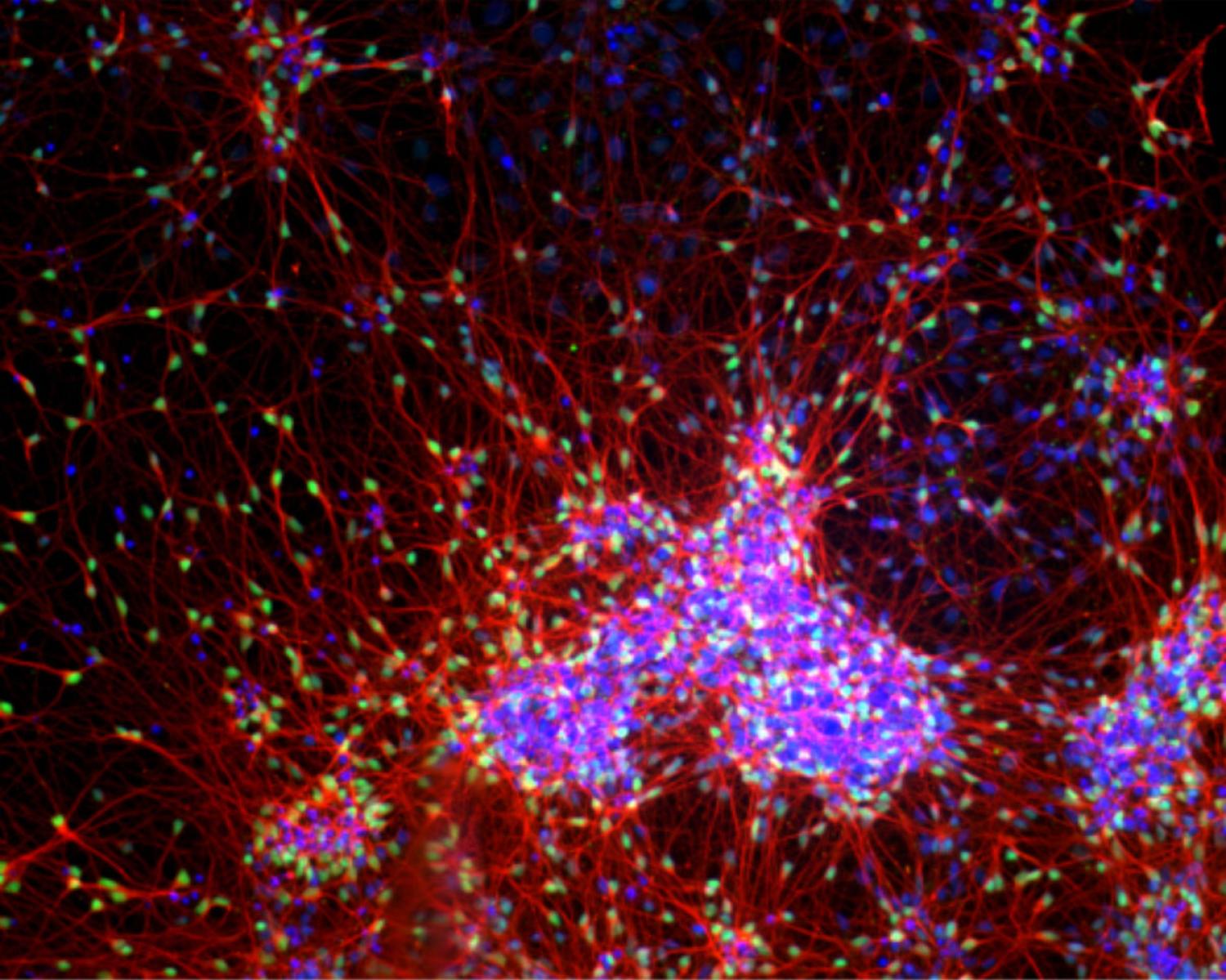 Cortical neuronal culture differentiated from iPSCs trisomic for chromosome 21 (40 days after initiation of differentiation protoco.) The culture is stained for DNA (blue), beta tubulin III (red) and cortical layer VI transcription factor TBR1 (green).