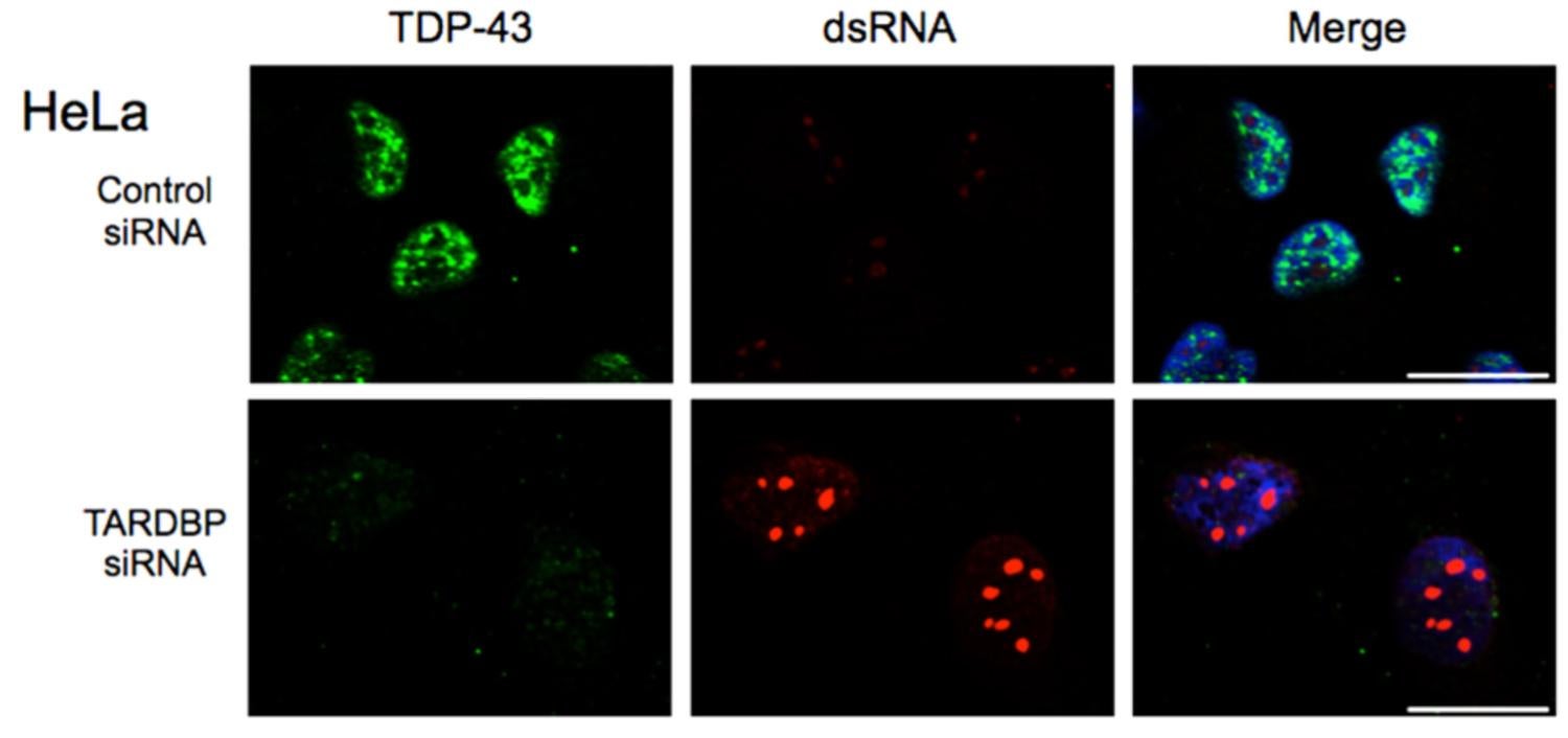 siRNA knockdown of TDP-43 in human HeLa cells results in an accumualtion of dsRNA From Saldi et al, 2014.