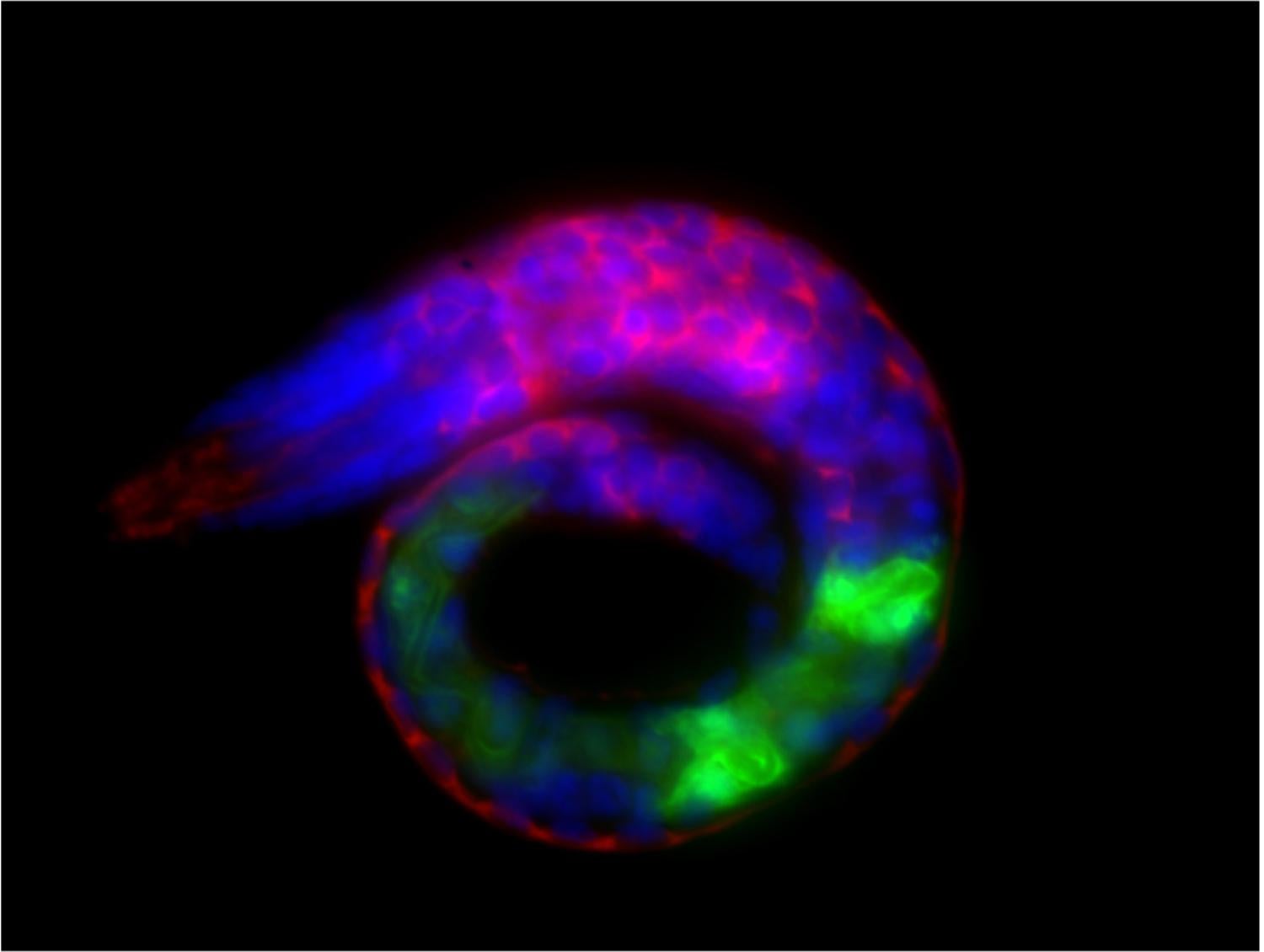 Larval C. elegans worm with pan-neuronal expression of human tau protein