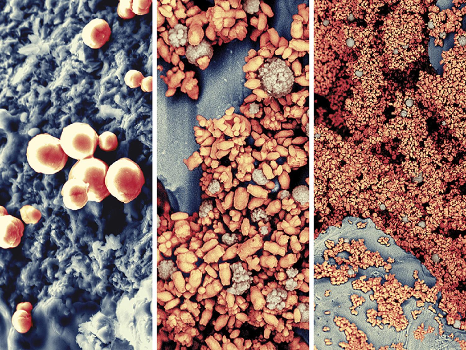 microbial life