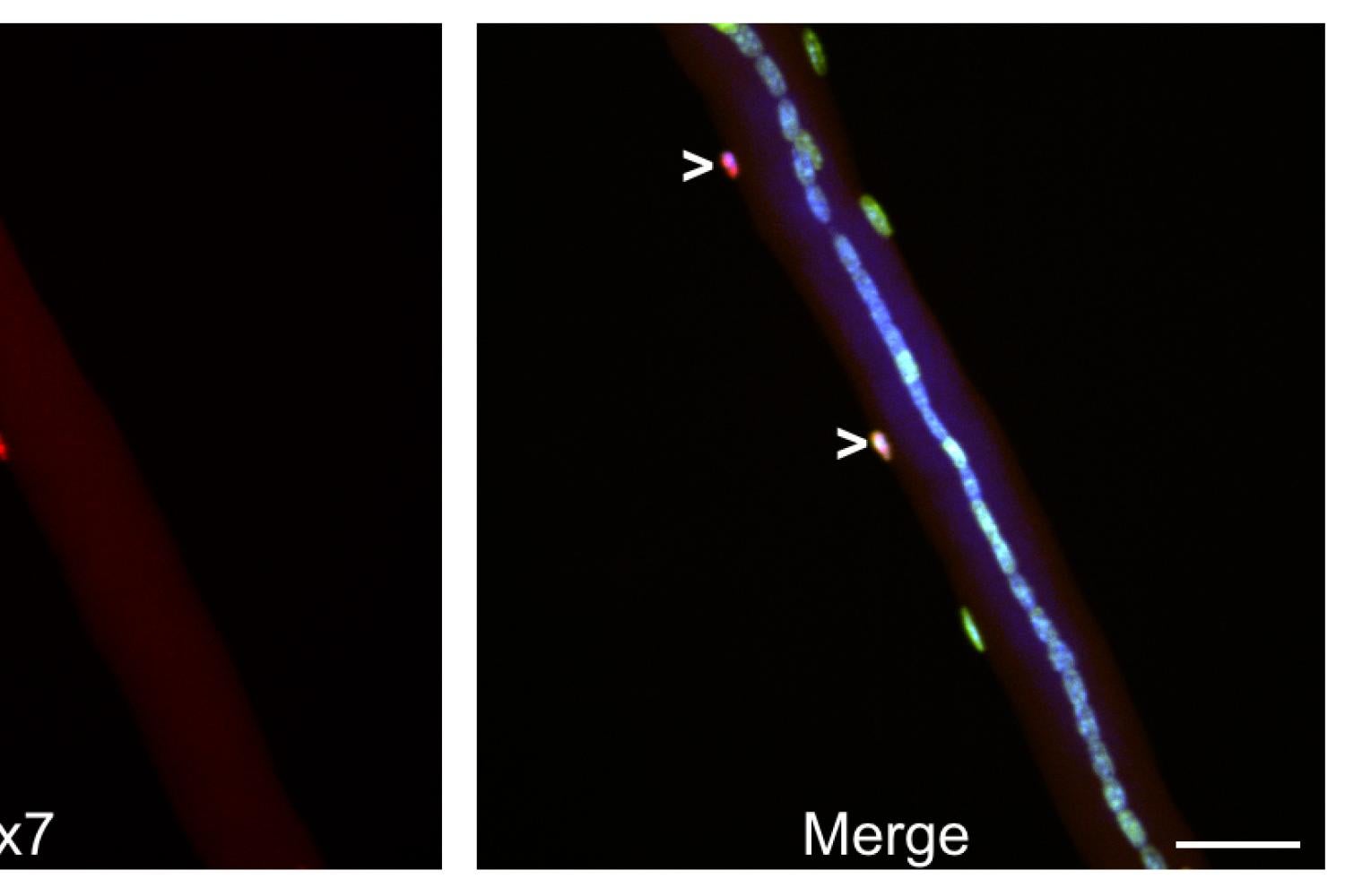 Myofibers isolated from a mouse fed EdU-containing water 14 days post-injury (Pax7 red, EdU green)