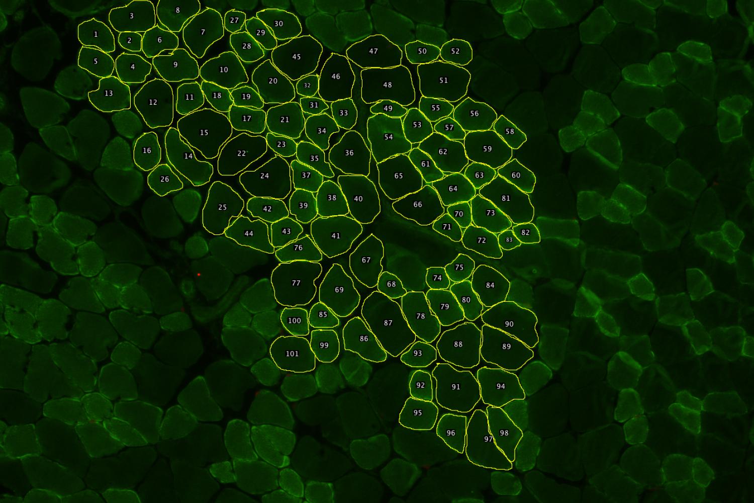 An image of skeletal muscle in cross-section (laminin is green)