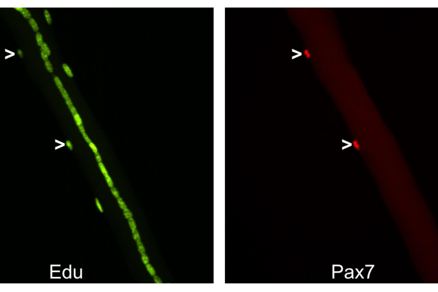 Myofibers isolated from a mouse fed EdU-containing water 14 days post-injury (Pax7 red, EdU green)