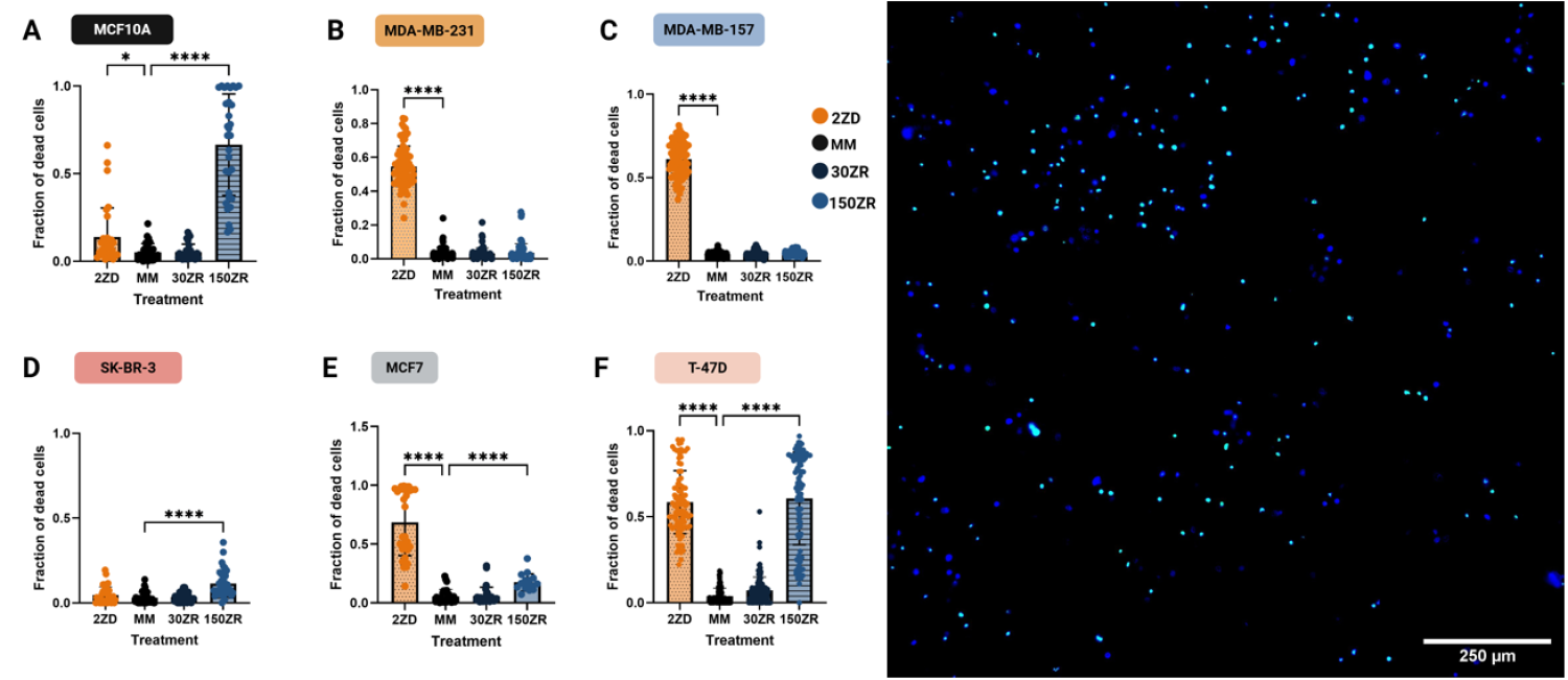 breast cancer and zinc