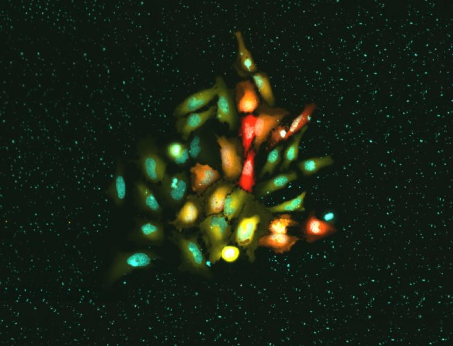 HeLa cells expressing genetically encoded zinc and kinase sensors, as well as a nuclear stain.