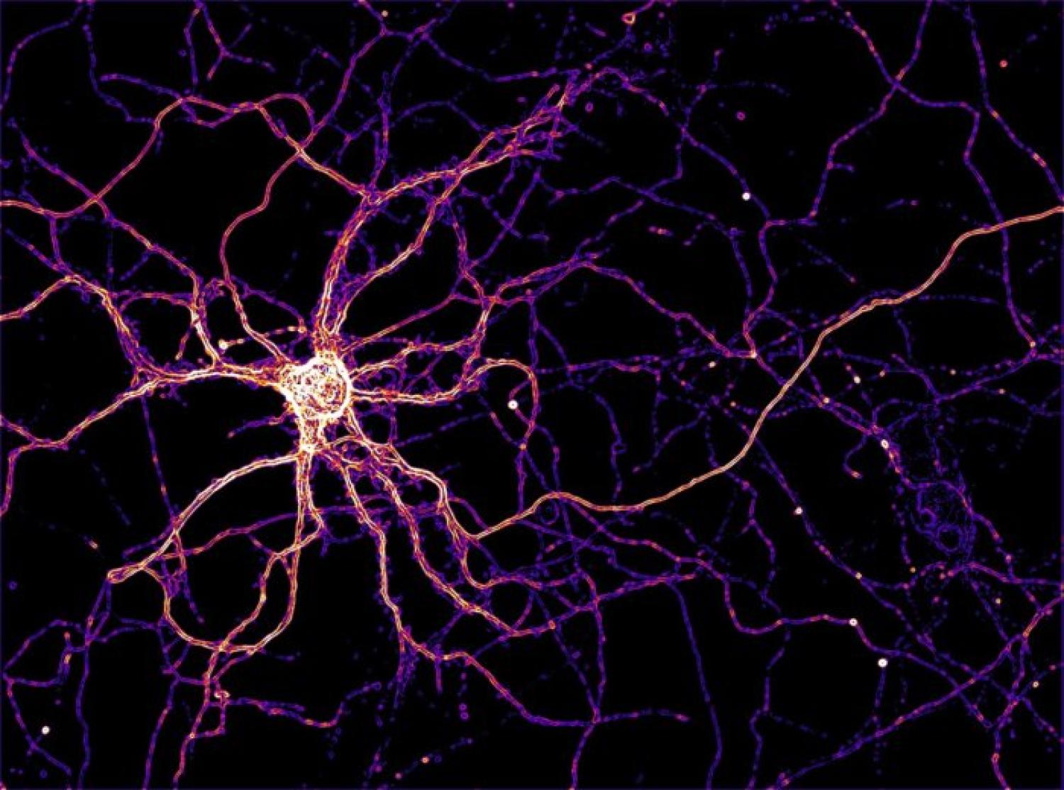 A hippocampal neuron expressing a zinc FRET sensor.