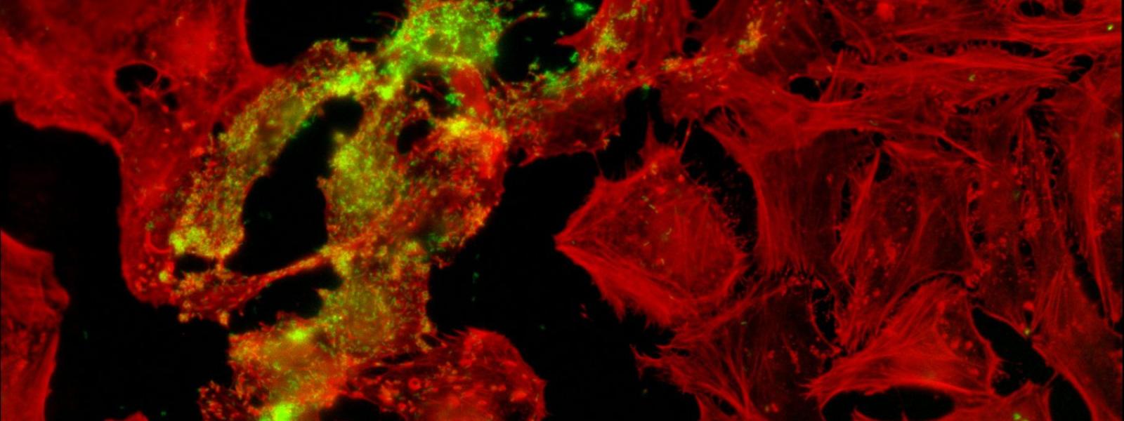 Listeria infecting HeLa cells stained with phalloidin.