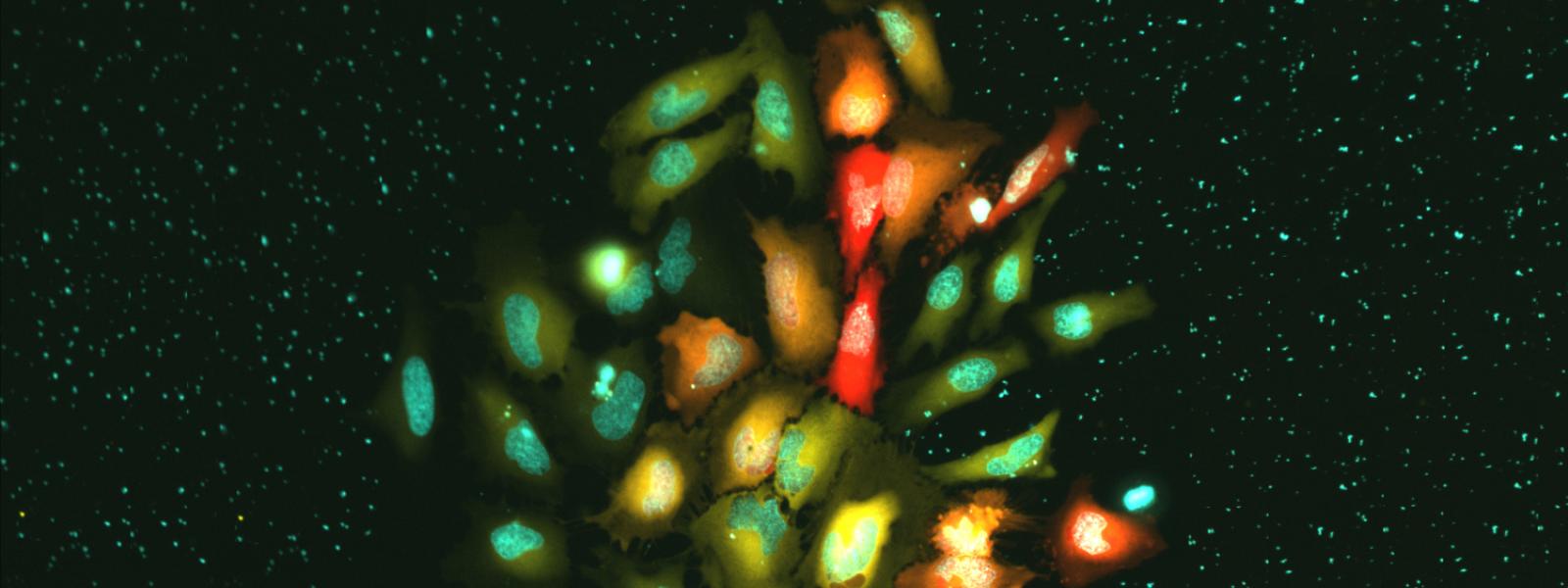 HeLa cells expressing genetically encoded zinc and kinase sensors, as well as a nuclear stain.