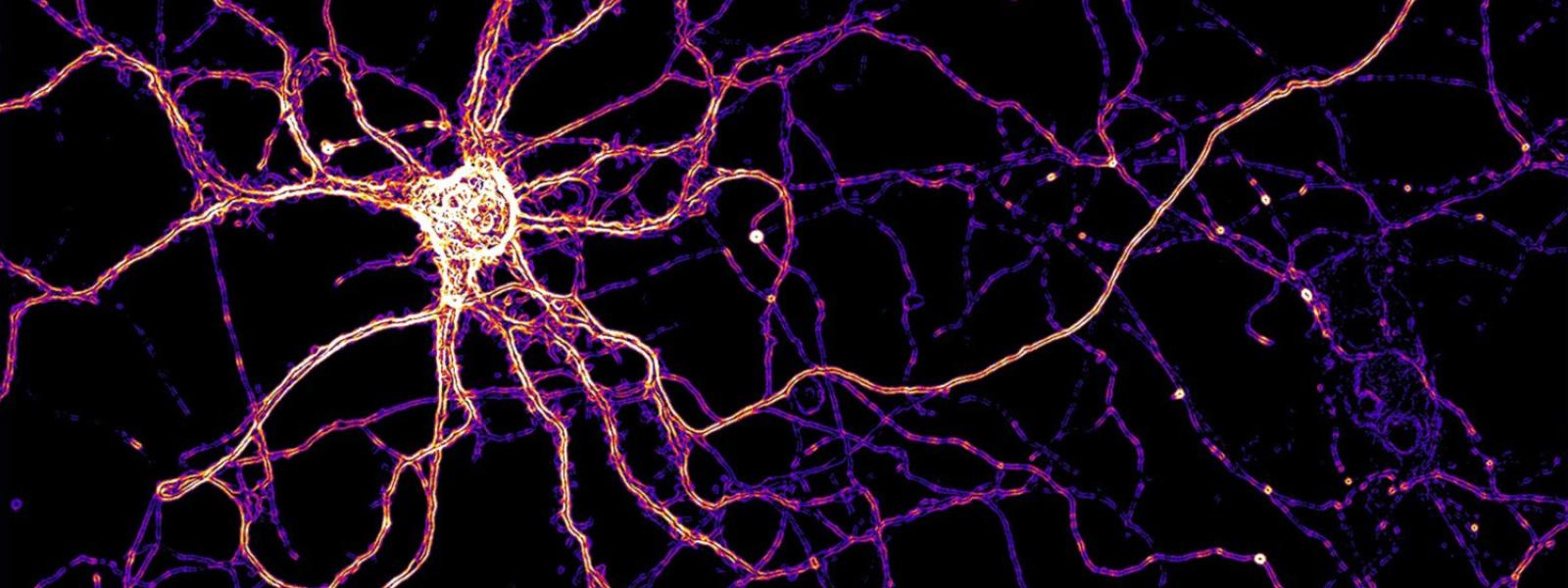 A hippocampal neuron expressing a zinc FRET sensor.