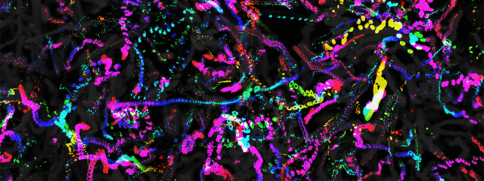 DNA stained with different colored dyes.