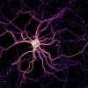 A hippocampal neuron expressing a zinc FRET sensor.