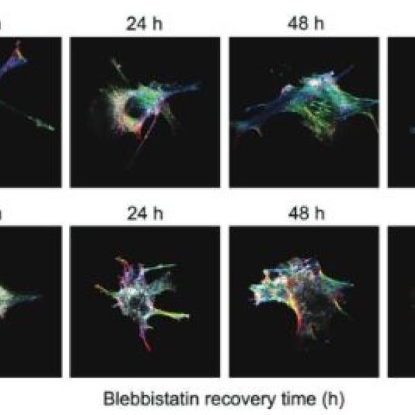 intracellular crowding