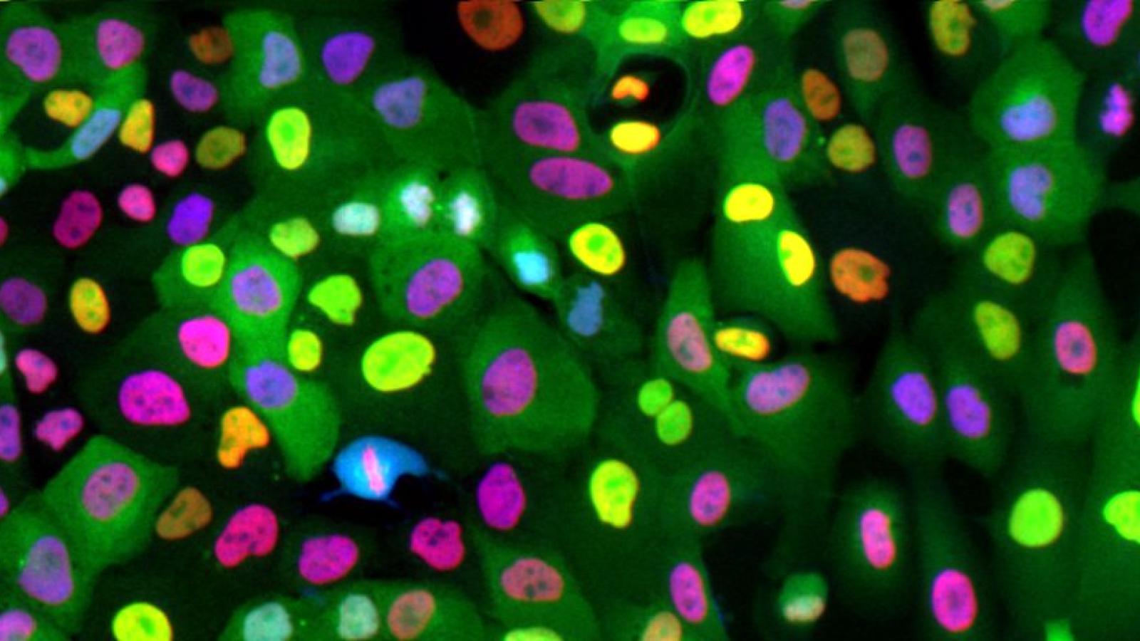 MCF10A cells expressing a CDK2 sensor (green) and mCherry-tagged Histone 2B (red); cells have been immunostained for phosphorylated Rb at Serine 807/811 (blue).