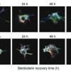 intracellular crowding