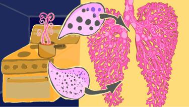 TOC image for Patel et al